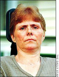 Patsy Byers after her injury